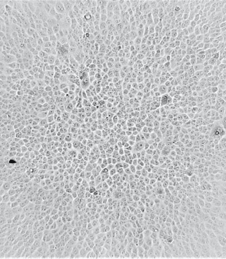 Cells are protected from killing by Ancestral SARS-CoV-2 after addition of serum from individuals vaccinated by Coronavac.